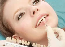 Escala de cores dentárias